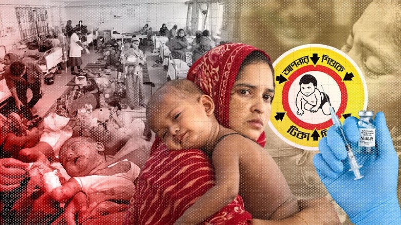 হাম উপসর্গে আরও পাঁচজনের মৃত্যু