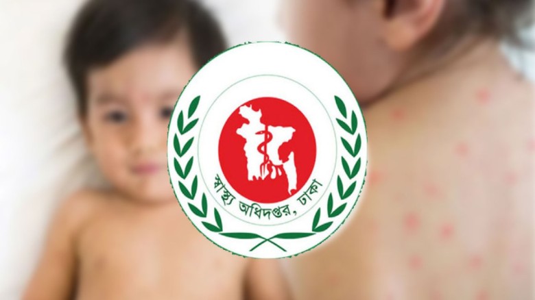 হামের উপসর্গে আরও ৭ শিশুর মৃত্যু
